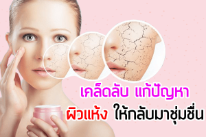 เคล็ดลับ-แก้ปัญหาผิวแห้ง-ให้กลับมาชุ่มชื่